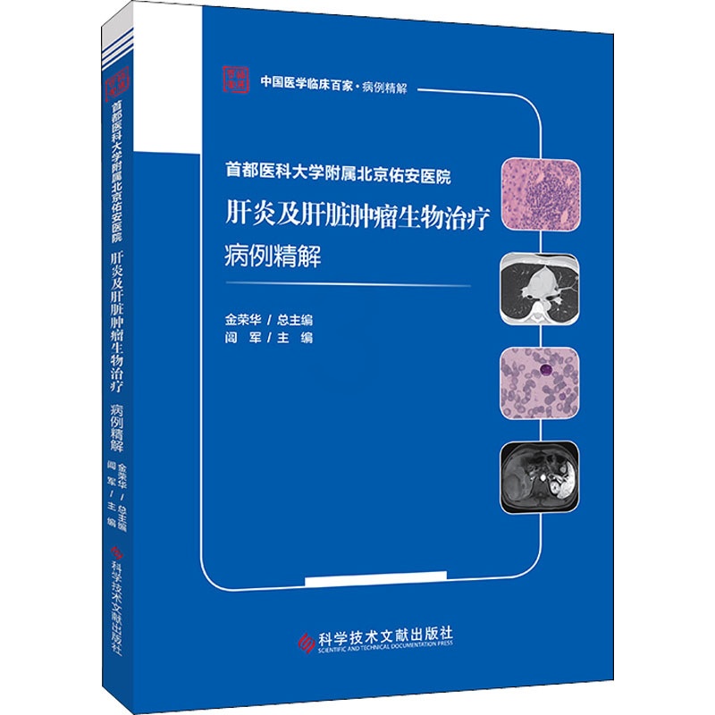 [正版]首都医科大学附属北京佑安医院肝炎及肝脏肿瘤生物治疗病例精解 闾军 编 内科学疾病诊治资料图书 医学类书籍 科学技高清大图