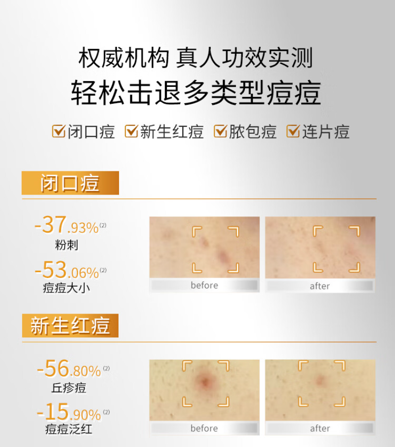 敷尔佳 乳糖酸控油敛肤面膜祛痘紧致肌肤 (乳糖酸面膜)25g*5片高清大图