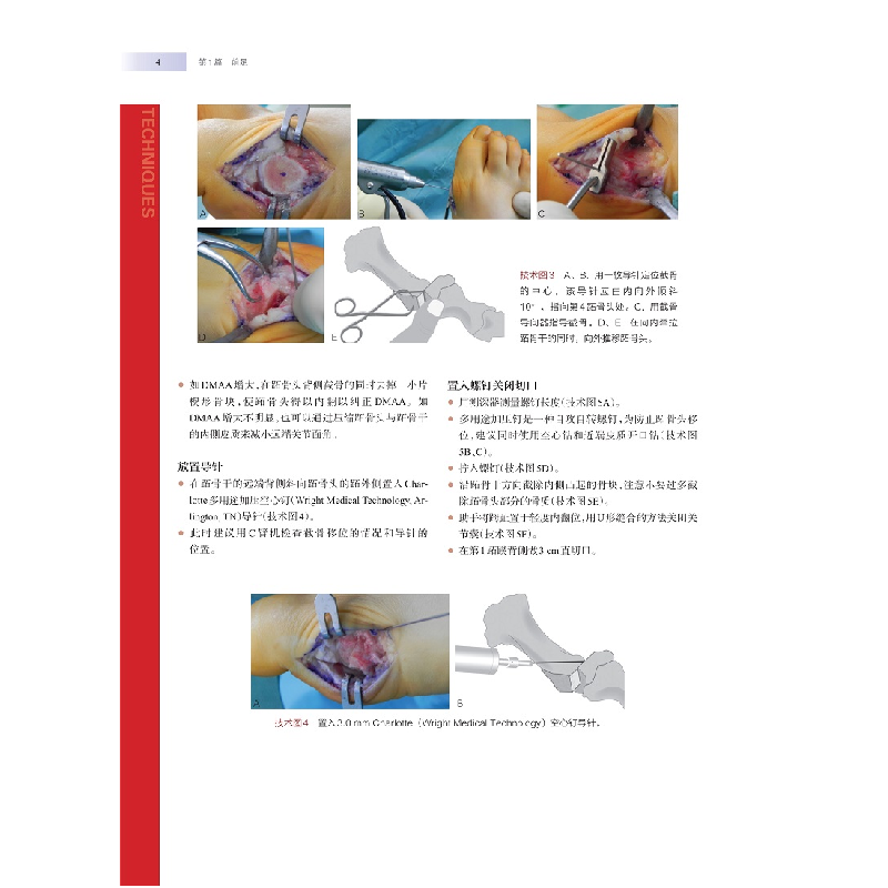 醉染图书WIESEL骨科手术学·足踝外科9787547855348高清大图