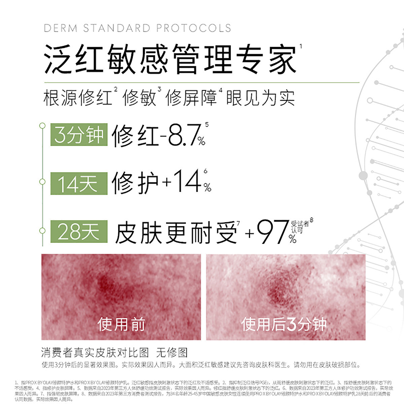 玉兰油(OLAY)修红特护水乳中样旅行装 舒缓修护补水润肤护肤品套装女高清大图