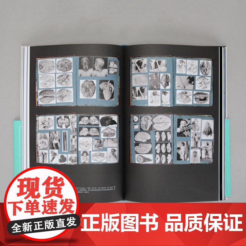 见证疯狂:精神病院的前世今生高清大图