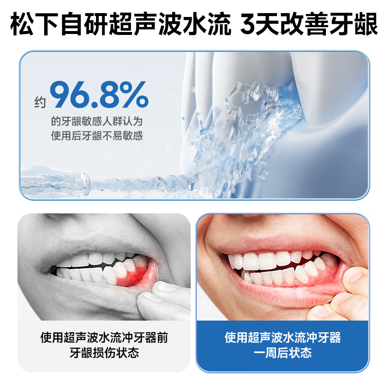 松下小白塔2.0冲牙器成人儿童超声波洁牙器牙齿冲洗器洗牙器水牙线牙结石生日节日礼物EW1520高清大图