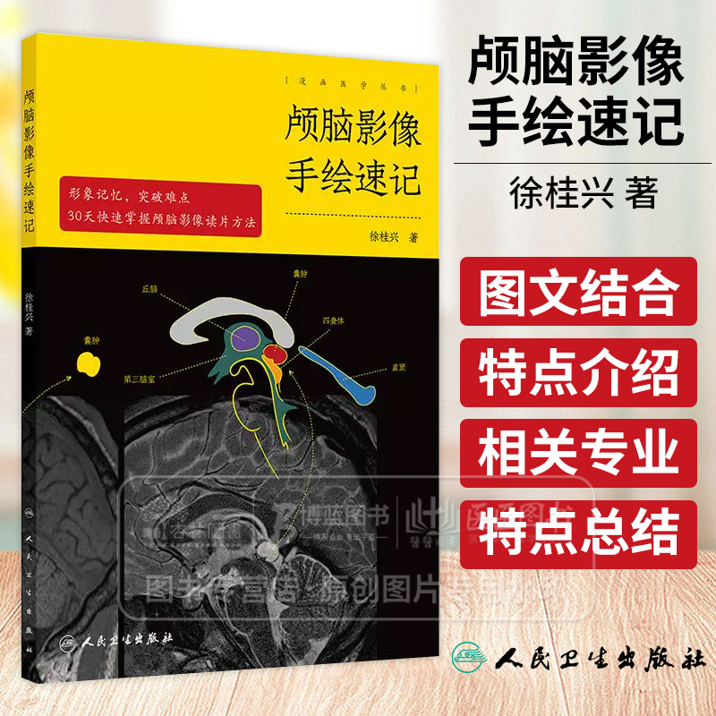 颅脑影像手绘速记 颅脑正常影像 高血压性脑出血 脑静脉出血和静脉窦血栓形成 颅内肿瘤 主编 徐桂兴 9787117 [正高清大图