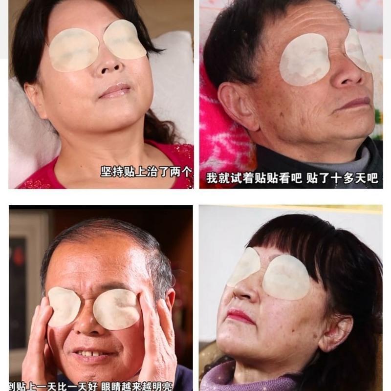 拨云明中老年眼贴飞蚊黑点玻璃体混浊眼干胀流泪畏光眼疲劳视疲劳 一盒装28.8元