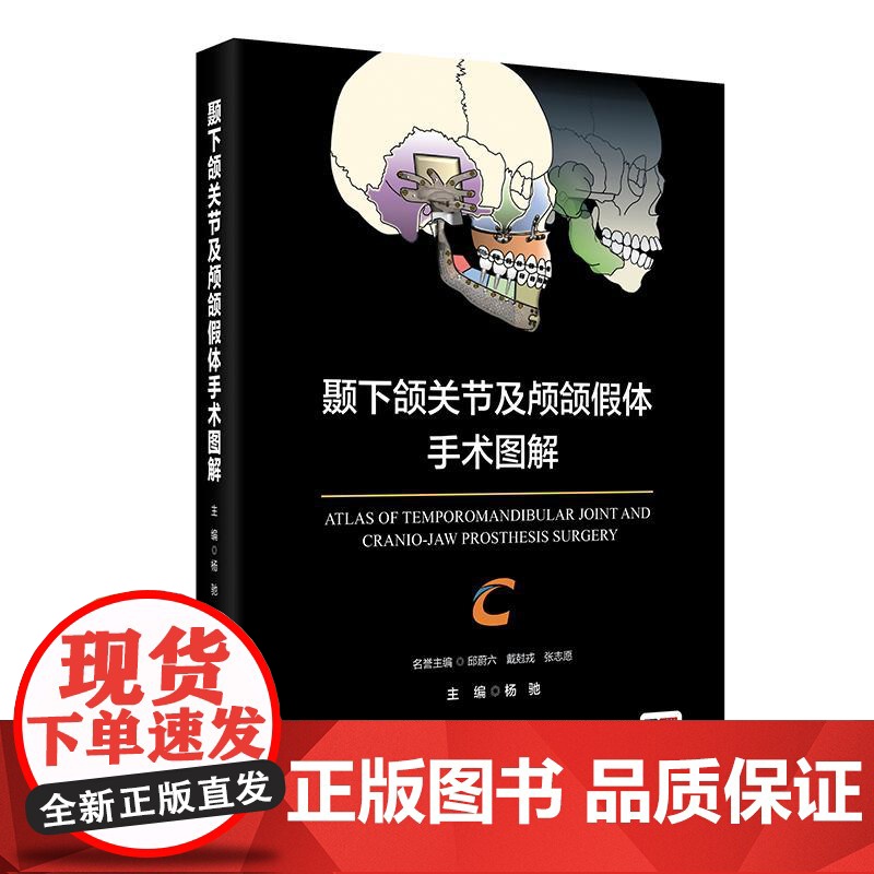 颞下颌关节及颅颌假体手术图解高清大图