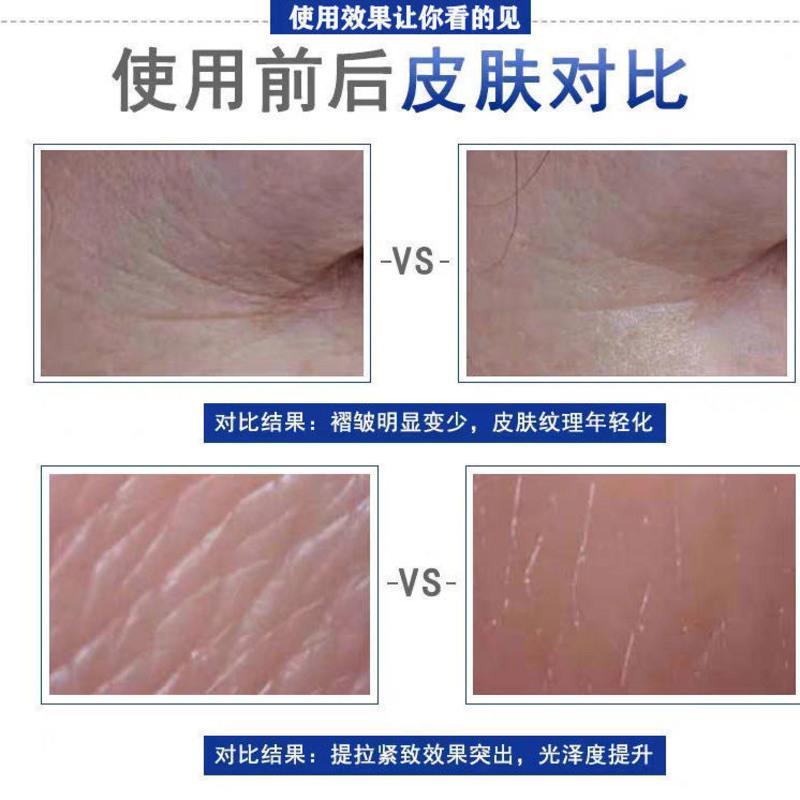 南京同仁堂绿金家园男士专用抗皱紧致去皱纹抬头纹面霜保湿护肤品 刚发现者使用-轻度皱纹*1 [全新升级]南京同仁堂绿金家园