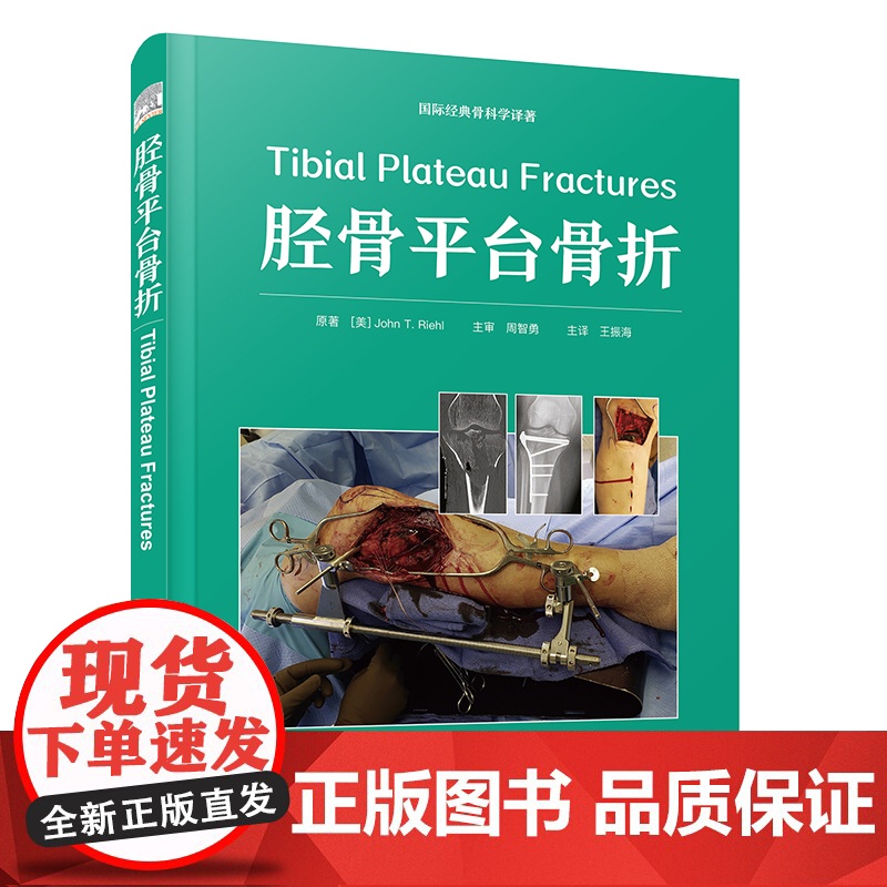 [央视网]胫骨平台骨折 Tibial Plateau Fractures 一部关于胫骨平台骨折的专业著作 ZK高清大图
