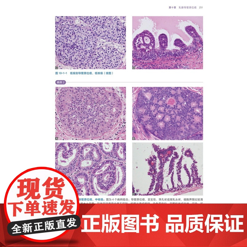 乳腺组织病理学图谱 上下册 乳腺组织学 乳腺疾病 病例讨论 高清图解 北京科学技术高清大图