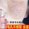 [一盒装]体验效果 收缩细致毛孔精华液祛痘去黑头粉刺修复粗大毛孔收缩水补水保湿