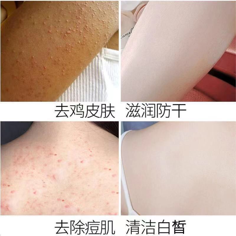 去黑神器全身嫩白酵素晶体皂去黑色素提亮女性私处粉嫩手工皂香皂 1盒酵素亮肤皂[送起泡网]