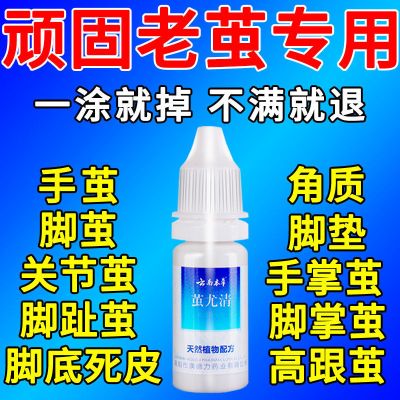 去脚死皮老茧脚底去除手上老茧硬皮脚茧软化剂脚趾头关节茧子神器 一盒装