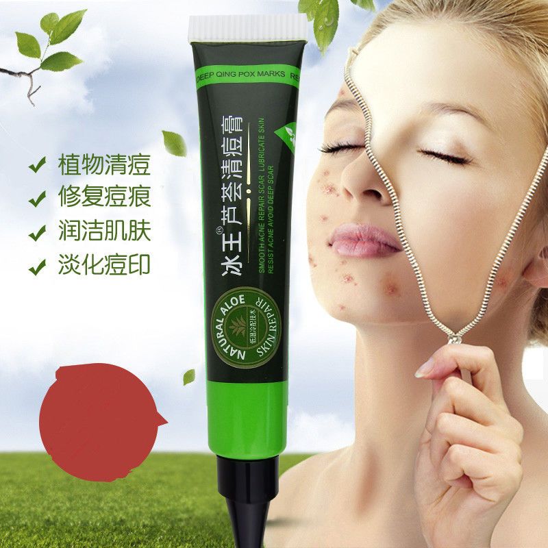 2送1]冰王芦荟清痘膏20g祛痘粉刺青春痘男女痘印修复霜抑菌膏>800_800