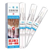 【优选】萱晴【买2送1】7天去灰指甲去灰指甲专用药手部足部护理灰指甲亮甲美甲定制定金
