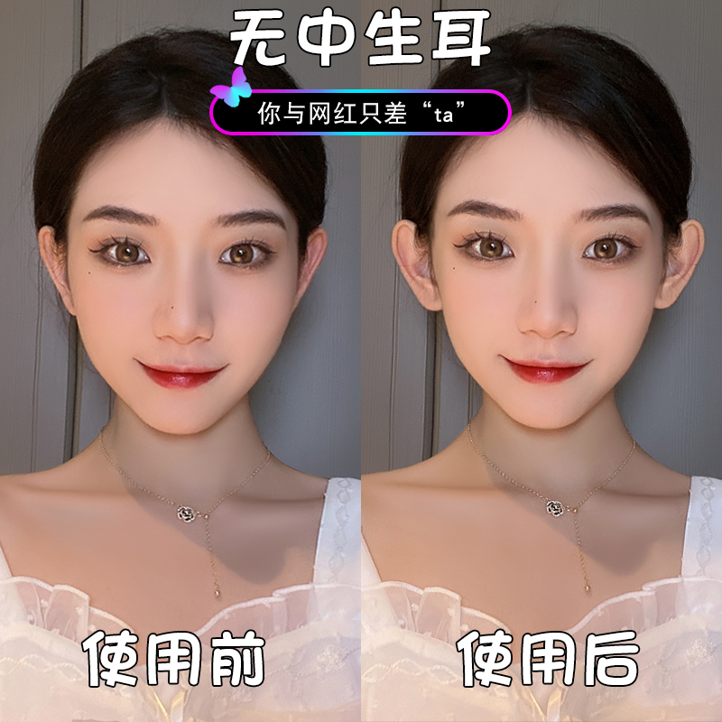 无耳洞精灵耳贴神器招风立耳贴女固定贴显脸小拍照矫正支撑器硅胶