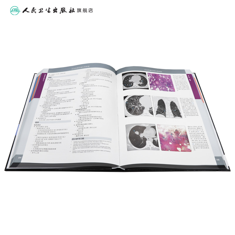 [正版]肺部高分辨率CT第二2版翻译赵绍宏学支气管炎肺部细菌感染肺结节肺癌病理胸部肺部超声诊断医学影像CT检查技术人民高清大图