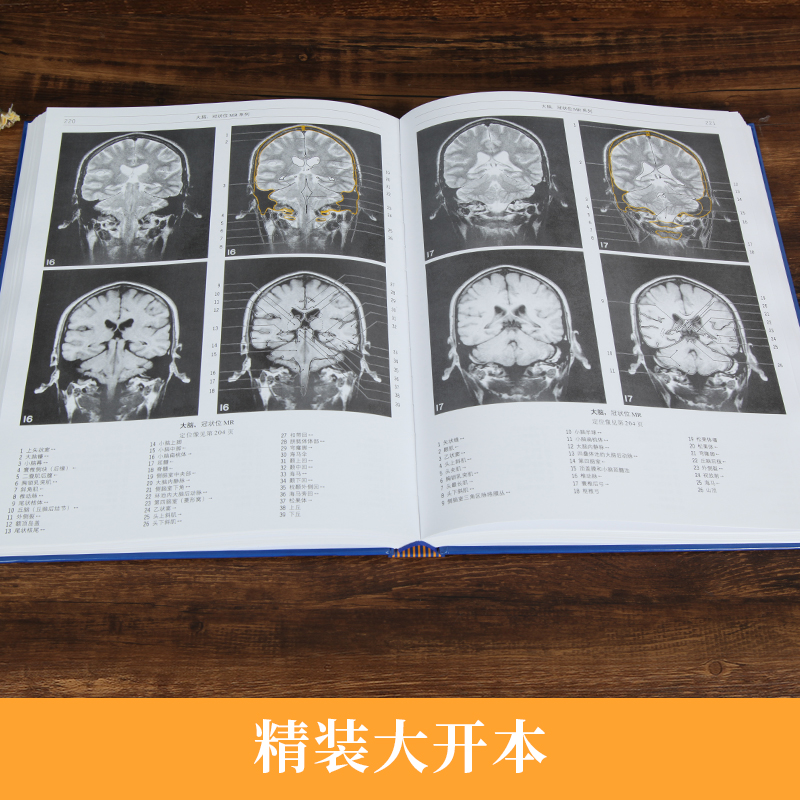 [醉染正版]正版 影像解剖学 影像医学 X线 CT 磁共振 超声波 核素扫描教程 解剖学图谱 影像解剖 影像医学书 丹麦高清大图