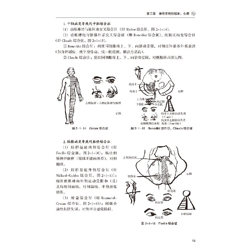 醉染图书脑卒中家庭康复训练图谱9787559127198高清大图