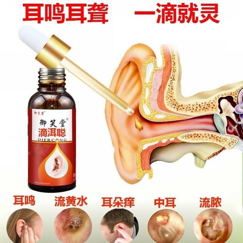 滴耳液人用中耳炎药滴耳油耳朵痒耳嗡耳响耳痛焖流脓黄水听力下降