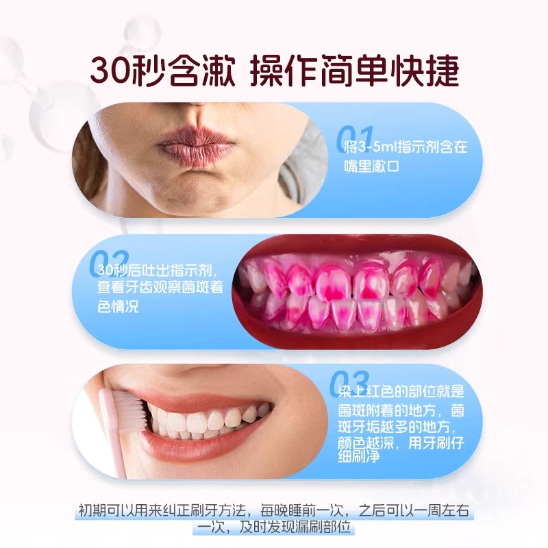 优利特医用牙菌斑显示剂指示剂儿童成人口腔牙齿牙垢祛除显色剂漱口液高清大图