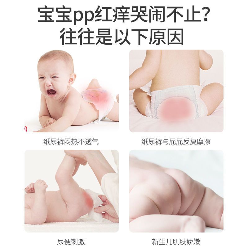 儿童红屁股防皴护肤膏PP霜宝宝红屁屁新生婴幼儿护臀膏红臀膏天然 宝宝护臀膏和爽身粉呵护宝宝