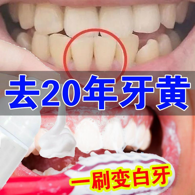 []洁牙慕斯牙膏美白牙齿去黄牙结石烟渍洗牙粉脱色剂 [随机发]限抢