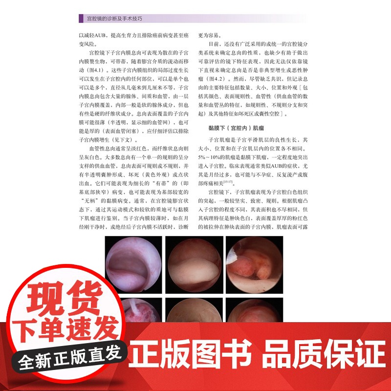 宫腔镜的诊断及手术技巧 子宫疾病 内窥镜检 妇科外科手术 北京科学技术高清大图