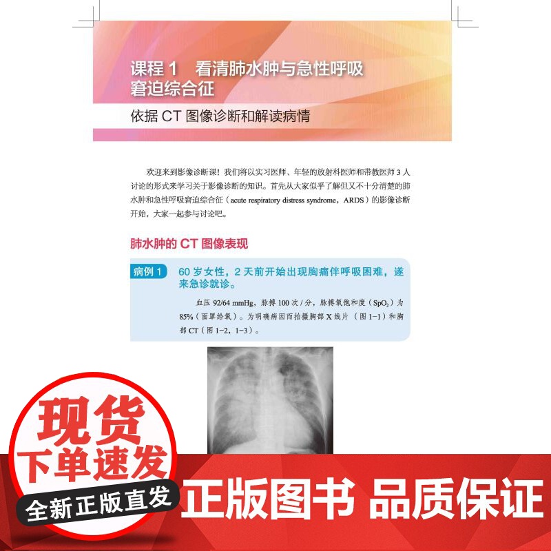 影像诊断技巧 要点与盲点 2 影像诊断 读片技巧 影像解剖 专家教你快速掌握影像读片技巧 北京科学技术高清大图