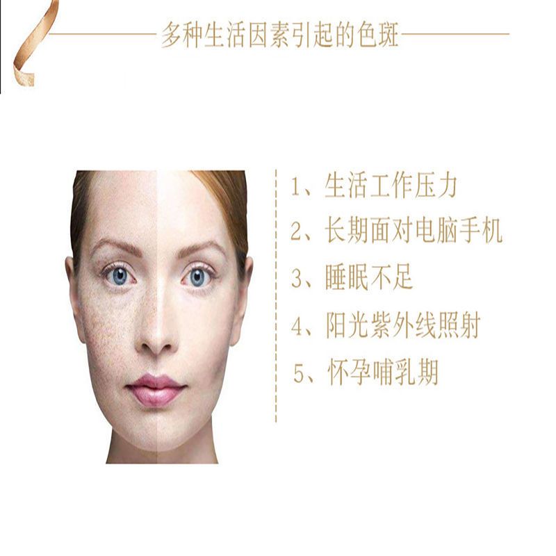 无创溶斑液去除真皮斑黄褐斑壬辰斑老人斑混合斑厂家批发不含仪器 无创溶斑液去除真皮斑黄褐斑壬辰斑老人斑混合斑厂家批发不含仪
