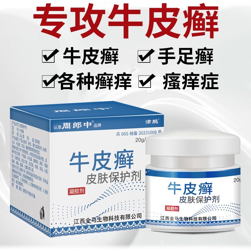 周郎中牛皮癣银屑专用手足癣大腿内侧股部全身皮肤瘙痒外用止痒