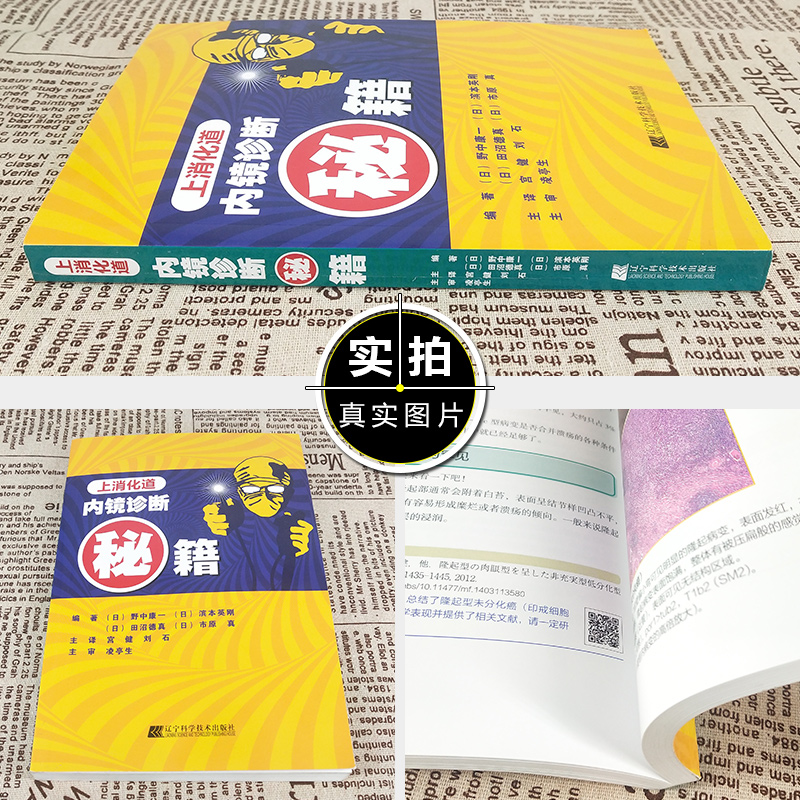 [正版] 上消化道内镜诊断的秘籍 主译宫健 刘石 消化系统疾病临床案例诊治教程参考工具书 辽宁科学技术出版社97875高清大图