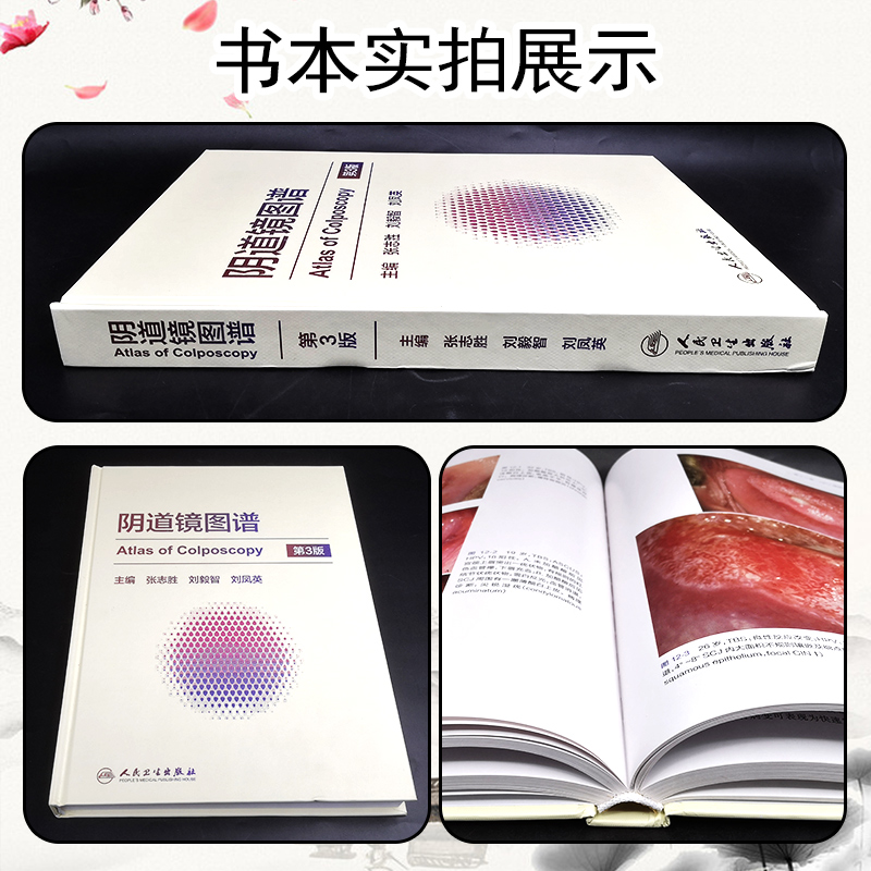 [正版] 阴道镜图谱第3版第三版 主编张志胜 刘毅智 刘凤英 西医内科临床现代阴道镜学基础知识人民卫生出版社 97871高清大图