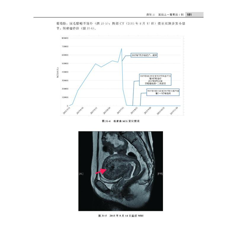 醉染图书北京大学妇产科学系疑难病例精粹(辑)9787565924高清大图