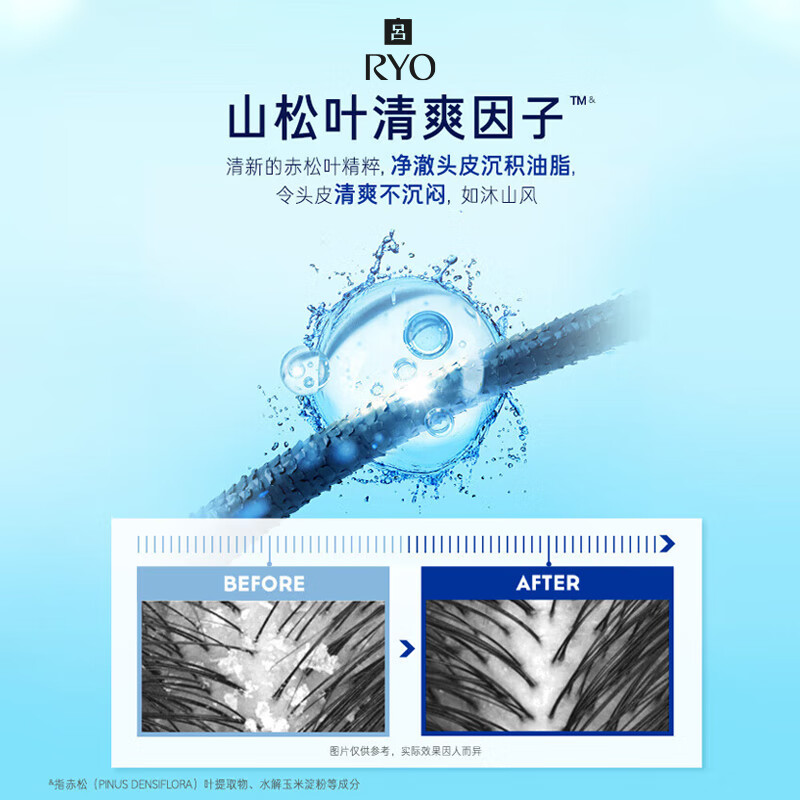 吕(Ryo)蓝吕男士控油去屑洗发水舒缓头皮洗发膏400ml高清大图