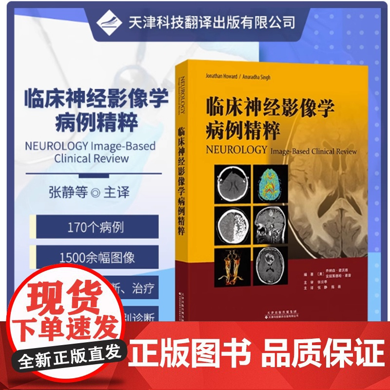 临床神经影像学病例精粹 神经系统疾病影像学 癫痫 脑血管病 自身免疫疾病 脱髓鞘性疾病等 神经病学领域 张静 陈薇主译