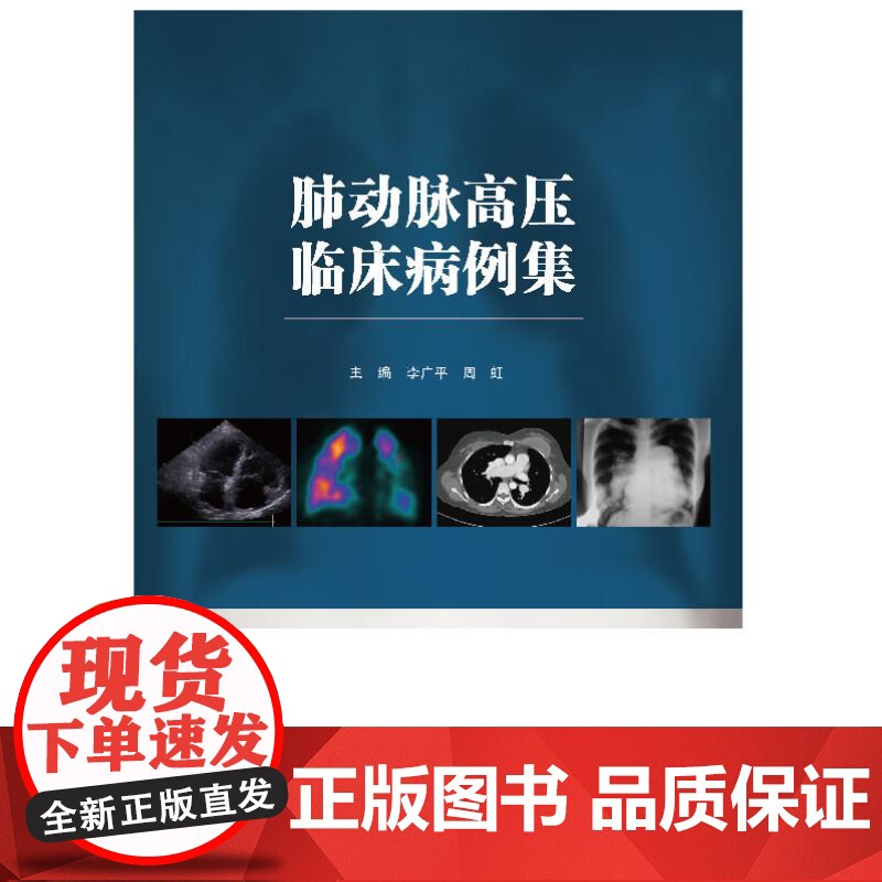 肺动脉高压临床病例集李广平天津科技翻译出版有限公司9787543345119 医学书籍高清大图