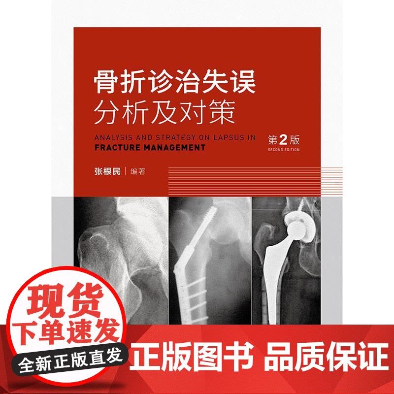 骨折诊治失误分析及对策 第2版 张根民 病史采集中的失误 对骨折的严重并发症重视不够 石膏固定不当的分析及对策人民卫生出图片