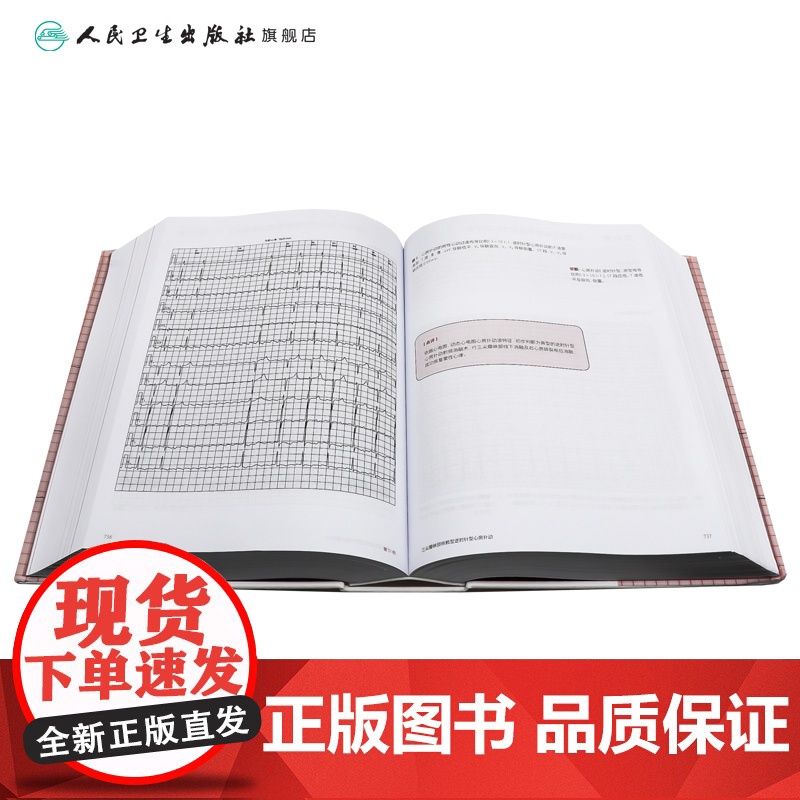 复杂心电图临床精解 冠状动脉粥样硬化性心脏病 结构性心脏病 心肌病与心肌炎 主编 卢喜烈 孙志军 97871173656高清大图