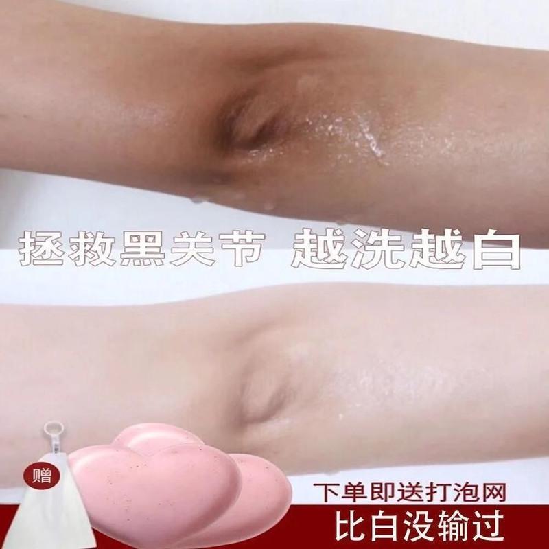 『全身白』臀部去黑色素美白PP皂脖子关节粉嫩大腿内侧屁屁手工皂 单盒装带起泡网