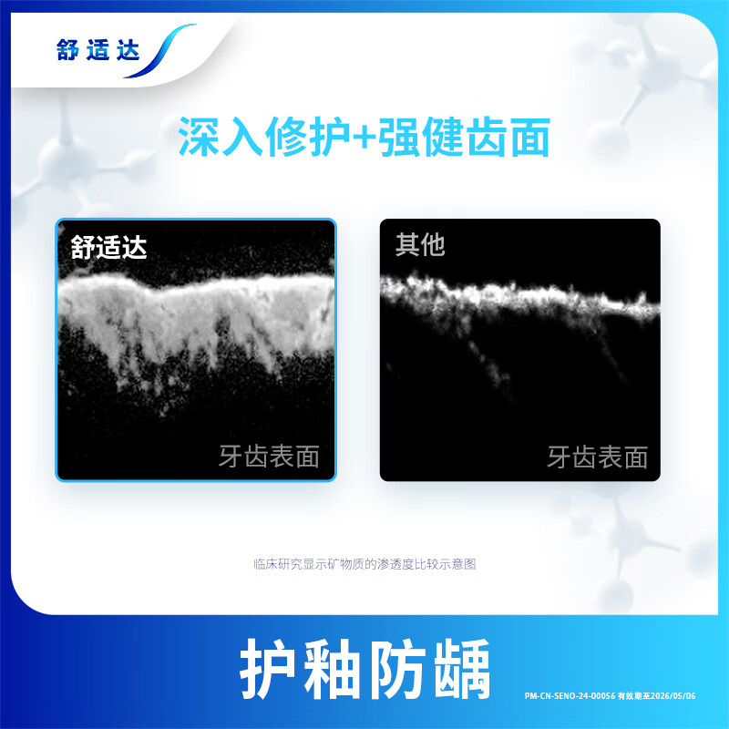 舒适达抗敏感牙膏180g*2支组合装(牙龈护理/劲速护理各一支) 缓解牙齿敏感高清大图