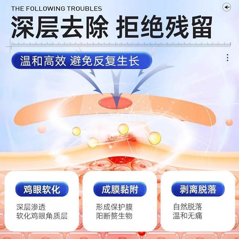 海氏海诺 鸡眼疣护理盒手足鸡眼疣肉茧瘊子扁平疣肉粒辅助治疗护理创可贴手脚鸡眼贴组合高清大图