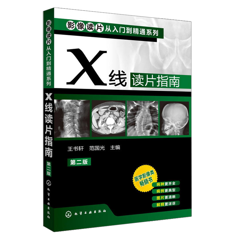 [醉染正版]影像读片从入门到精通系列(第二版)CT读片指南+MRI读片指南+X线读片指南套装3册医学超声影像诊断 学诊断高清大图