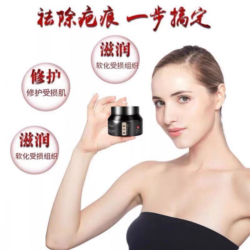 去疤膏正品疤痕凹凸疤痕修护膏剖腹产手术伤疤除疤贴烫伤痘印图片