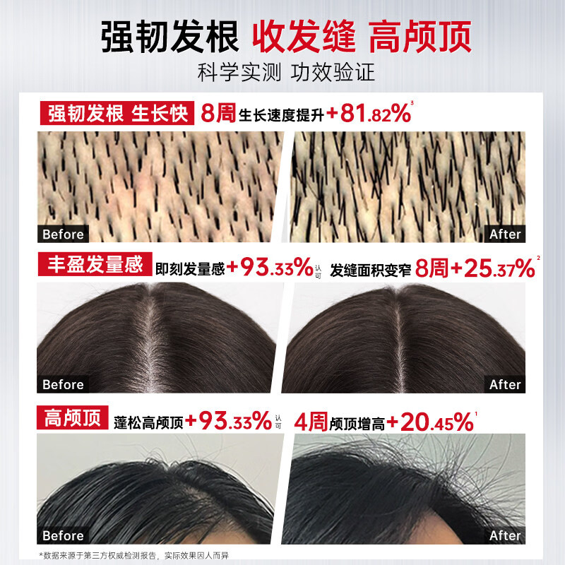 卡蓓诺CABELO负离子直发梳智能恒温护发造型梳顺滑不伤发便携设计高清大图