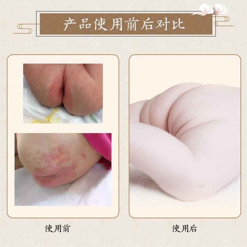 【宝宝必备】丽清堂中草药婴儿屁屁膏15g宝宝护臀霜 尿布疹红屁屁油性膏破皮可用隔尿