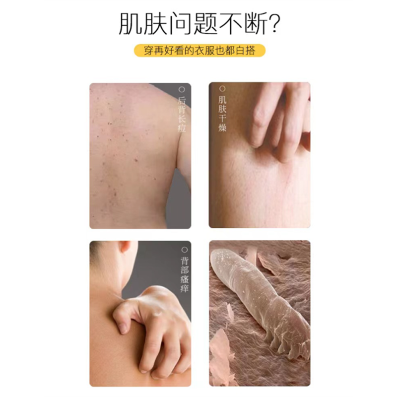 友岑硫磺除螨液体香皂深层清洁沐浴露/瓶(300ml)