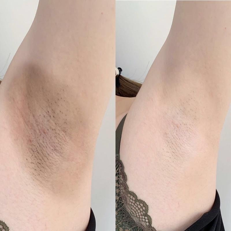 去黑神器腋下脖子阴部私处去黑色素全身pp皂去黑色素蜜桃手工皂体验装