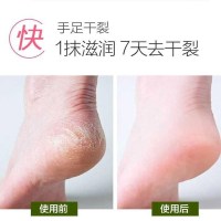 （拍2发3瓶）壹宝马油足膏护理霜防冻干裂皲裂龟裂开裂马油清36g去脚气脚臭脱皮止痒脚裂霜烂脚丫护手足霜脚气清