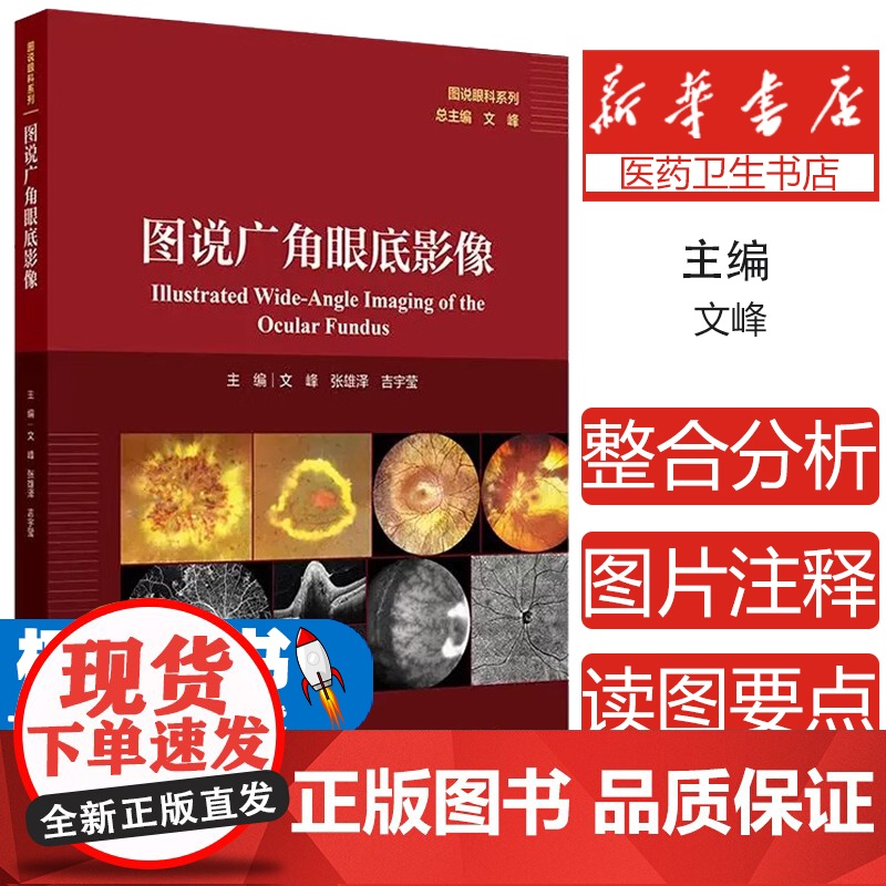 图说广角眼底影像 主编文峰 张雄泽 吉宇莹 遗传性视网膜脉络膜病变 眼底炎症与感染 视网膜血管性疾病9787117370