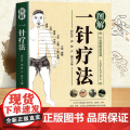 【正版】图解一针疗法 虽细物道通神上合于天下合人中医学教程书籍 针灸疗法穴位中医临床腧穴定位操作方法书籍中医学针灸入疗