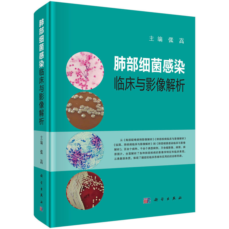 [正版] 肺部细菌感染临床与影像解析 张嵩肺部影像流行病学肺部几大类细菌感染临床表现影像特点临床医学呼吸科影像科全科医师